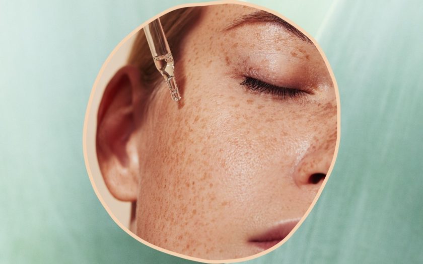 pigmentation spots in spring