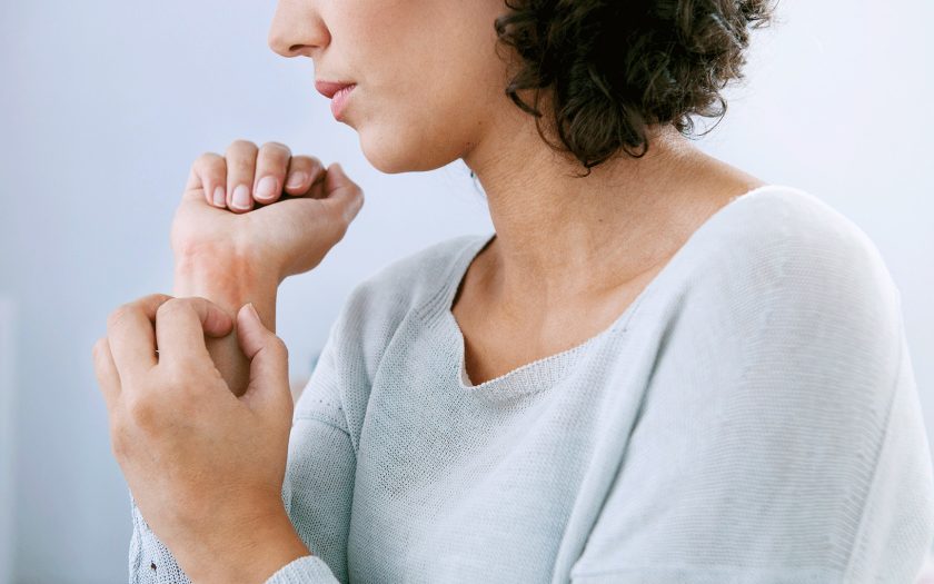 psoriasis